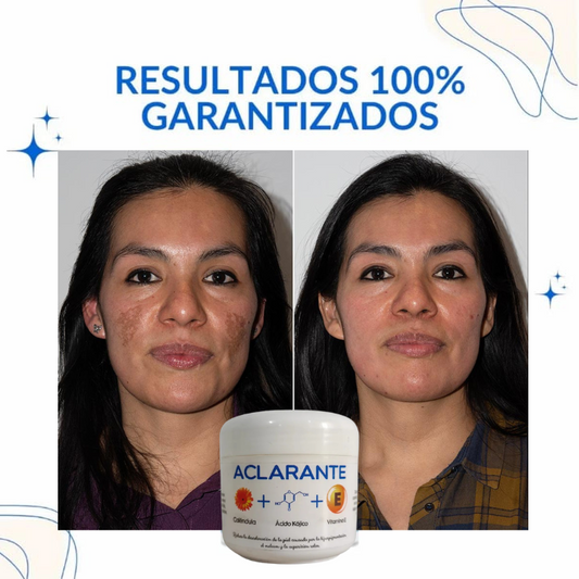 3 TONOS MAS CLAROS: Tratamiento Aclarador PRO con Envío GRATIS.