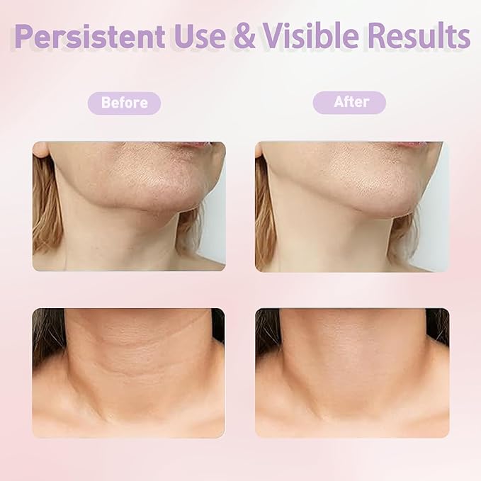 LumiGlow - Masajeador Facial LED Luce 10 años mas joven.