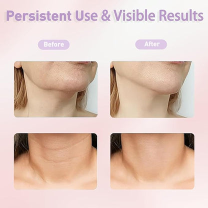 LumiGlow - Masajeador Facial LED Luce 10 años mas joven.