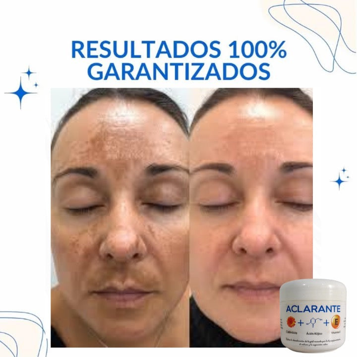 3 TONOS MAS CLAROS: Tratamiento Aclarador PRO con Envío GRATIS.