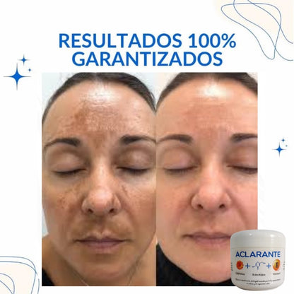 3 TONOS MAS CLAROS: Tratamiento Aclarador PRO con Envío GRATIS.