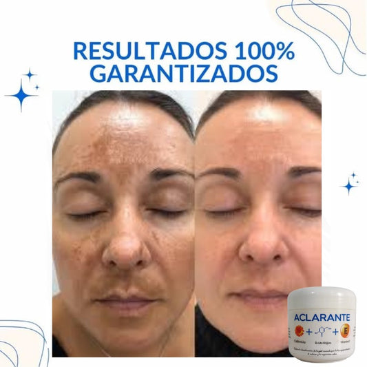 3 TONOS MAS CLAROS: Tratamiento Aclarador PRO con Envío GRATIS.