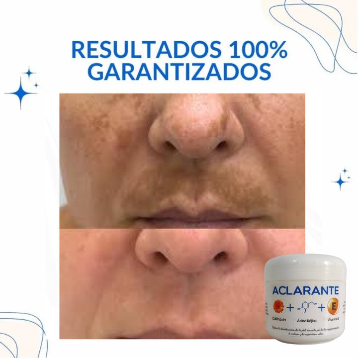 3 TONOS MAS CLAROS: Tratamiento Aclarador PRO con Envío GRATIS.